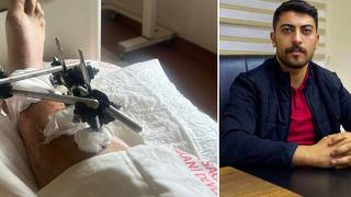 AK Partili vekilin kardeşinden silahlı saldırı! AK Partili vekil Çalkın açıklama yaptı: 'Aileme ve bana dayanaksız iddialarda bulundu'