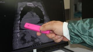 Dünyada bir ilk: Hastanın tüm organları yer değiştirdi! Giresun Sendromu tıp literatürüne girdi