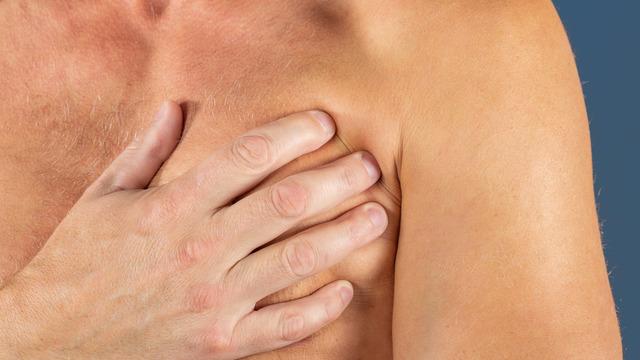 'Yağ bezesi deyip geçiyorlar' Erkeklerde meme kanseri görülme sıklığı artıyor!