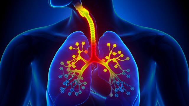 Bronşite ne iyi gelir? Bronşit neden olur, en hızlı nasıl geçer?