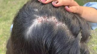 Acil serviste darbedildi, saçları kopartıldı! Doktor İrem: Güvenli hissetmiyorum