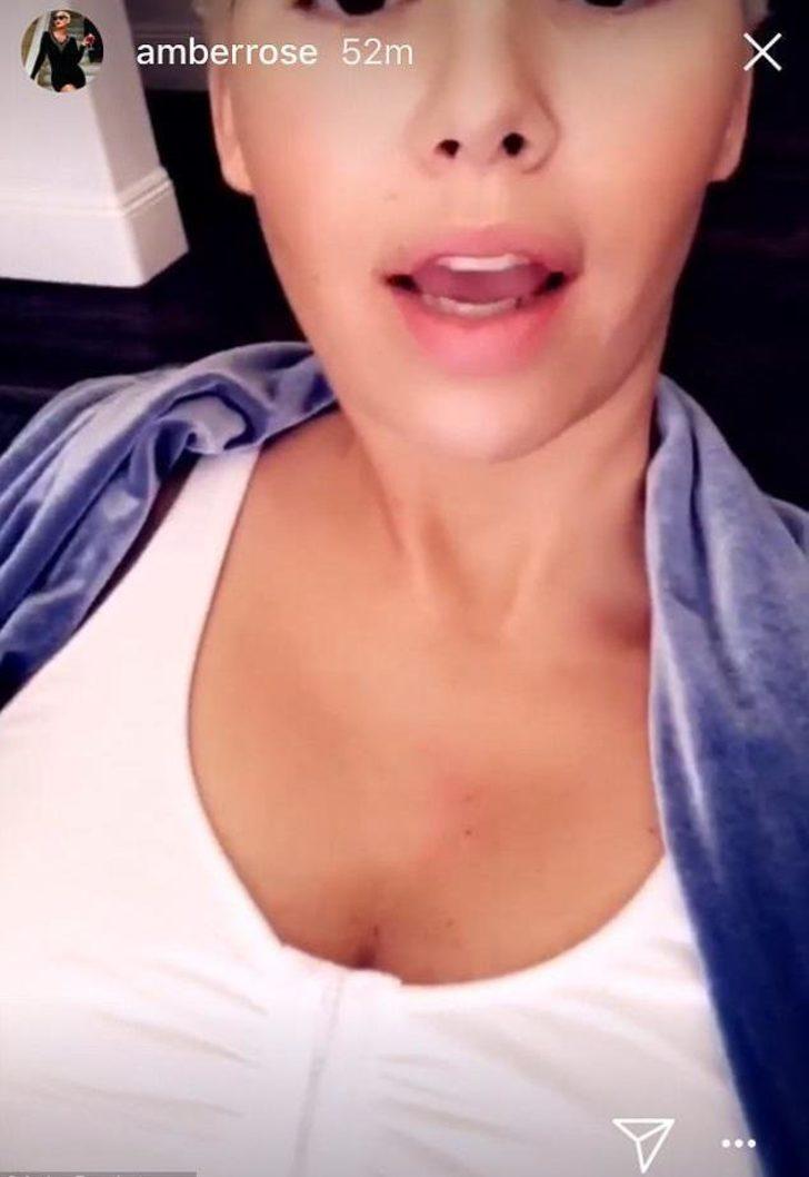 Yenilenmiş göğüsleriyle ilgili açıklama yaptı  G1