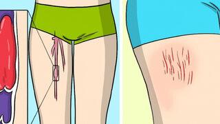 Kan pıhtısının uyarı işaretleri! Önemsenmemesi ölüme neden oluyor