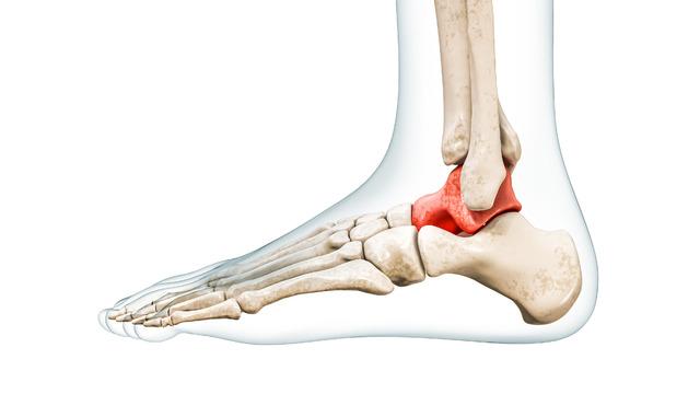 Talus kemiği nedir? Talus kemiği neden ağrır, neden şişer?