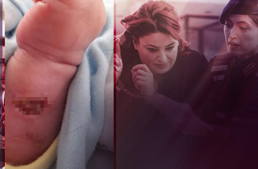 3 bebeklerini kaybeden aile bir kez daha yıkıldı! 'Bebeğimin v&uuml;cudundaki yanık izinden kemikleri g&ouml;z&uuml;k&uuml;yordu' 