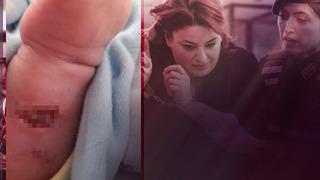 3 bebeklerini kaybeden aile bir kez daha yıkıldı! 'Bebeğimin vücudundaki yanık izinden kemikleri gözüküyordu' 