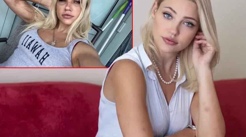 Her satırı korkunç! Plastik cerrah sevgilisi tarafından işkenceye uğradı: Tecavüz, taciz, darp, istismar... Anestezi kullanmadan cerrahi işlem yaptı