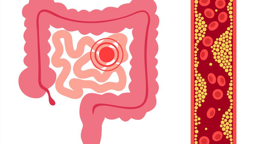Soluduğumuz havadan nerede yaşadığımıza kadar bile etkiliyor... Bağırsak sağlığı için uzman isim uyardı! "Kanser riskini azaltıyor”