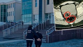 Ekipler bile şaşkına döndü: Uyuşturucuyu öyle bir yerine gizlemiş ki... 94 parça halinde yarım kilo ağırlığında!