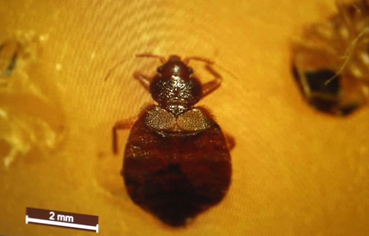 5 yıldızlı otellerde tahtakurusu alarmı: Yumurtaları valizle taşınıyor! 'Gece gelip, sizden kan emiyor' G3