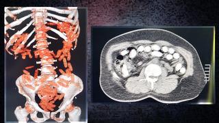 Kaçakçılıkta yeni taşımacılık... O maddenin, uyuşturucu ticareti yapan şahsın neresinden çıktığına inanamayacaksınız!