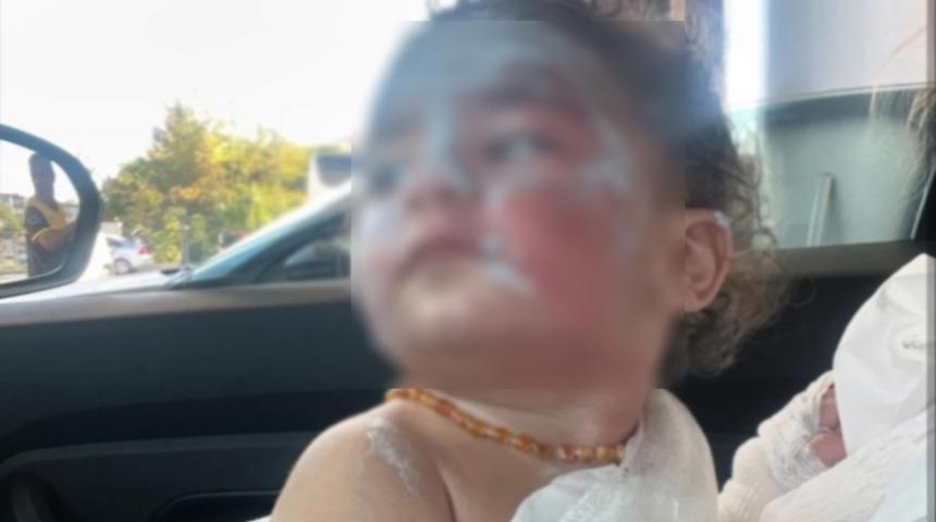 1,5 yaşındaki bebeği yakıp, ailenin şikayetçi olmasına engel olmaya çalıştılar!