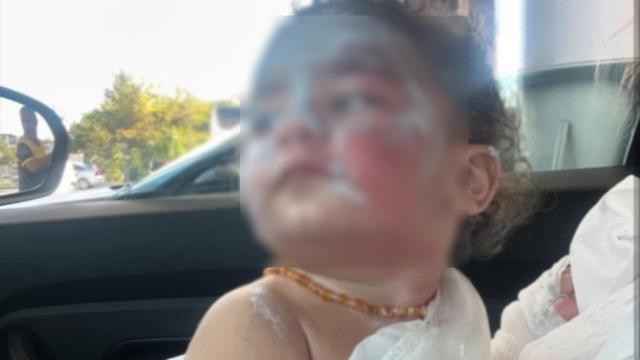 1,5 yaşındaki bebeği yakıp, ailenin şikayetçi olmasına engel olmaya çalıştılar!