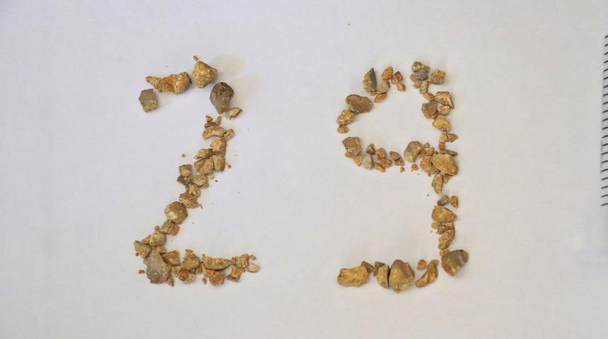 Yok böyle kutlama! Böbrekten çıkardığı taşlarla 29 yazıp Cumhuriyet Bayramı'nı andı...