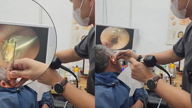 Kulağına sinek kaçan adamın tedavisini saniye saniye gösterdi! O anlar sosyal medyada gündem yarattı