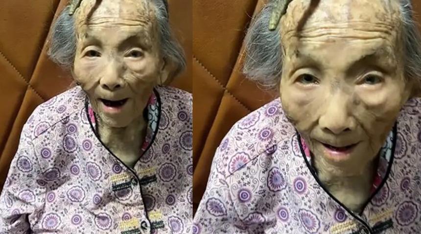 Alnında 10 cm'lik boynuzla yaşıyor! 107 yaşındaki kadını gören inanamıyor: 'Şeytan boynuzu' denildi... Sosyal medyada viral olmayı başardı