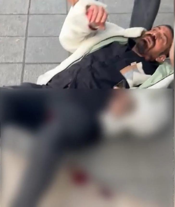 Kıskançlık krizine girip eski sevgilisinin yeni sevgilisini vurdu! Belinden çıkardığı silahla 3 el ateş etti G5