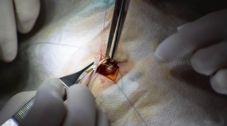 Hazımsızlık şikayetiyle doktora gitti! İnce bağırsağından canlı hamam böceği çıktı