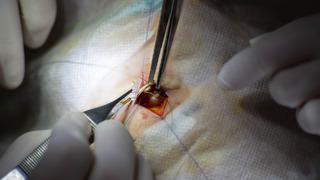 Hazımsızlık şikayetiyle doktora gitti! İnce bağırsağından canlı hamam böceği çıktı