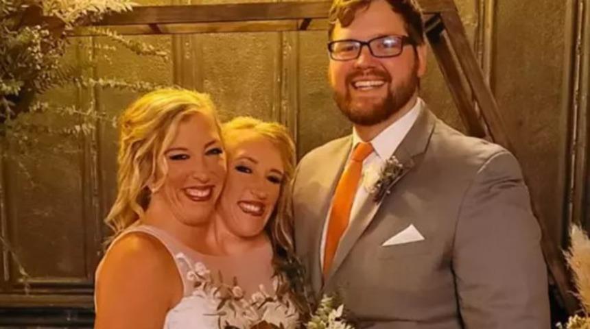 Herkes 'boşanacaklar' demişti! Yapışık ikizler Abby ve Brittany Hensel mutlu evliliklerinden yeni pozlarını paylaştı... Sosyal medyada viral oldu