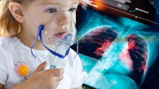 Öksürükten kurtulamıyor musunuz? Yeni tehlike: Yürüyen zatürre artışta! Soğuk algınlığı ile karıştırmayın