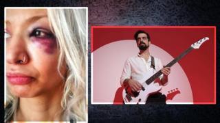 Sevgilisini darp etmişti, savunması şaşırttı! Yüzyüzeyken Konuşuruz gitaristine hapis cezası! 