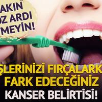 Dişlerinizi fırçalarken fark edeceğiniz kanser belirtisi!