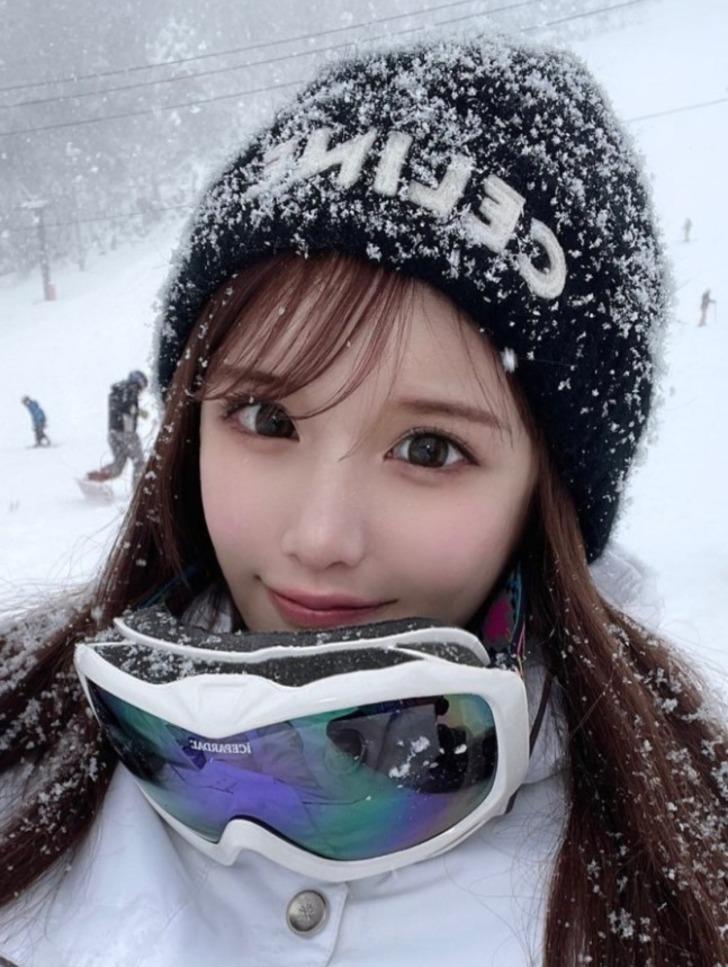 O eski halinden eser yok! 27 estetik operasyonun sonrasında gören tanıyamadı... Servet harcadı bambaşka biri oldu G5