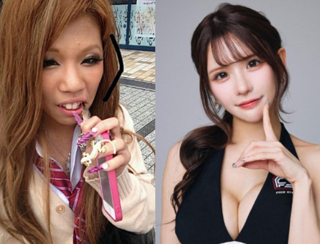 O eski halinden eser yok! 27 estetik operasyonun sonrasında g&ouml;ren tanıyamadı... Servet harcadı bambaşka biri oldu