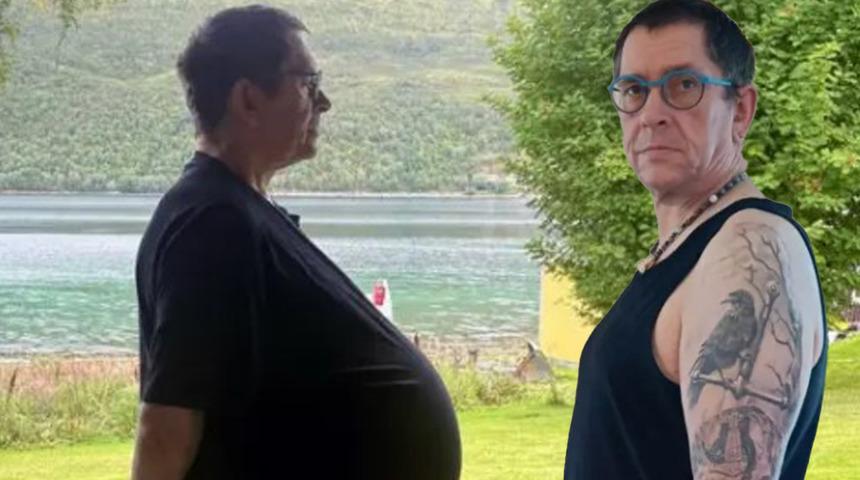 Herkes fazla kilolu olduğunu düşünüyordu! Kilosu yüzünden işinden bile kovuldu... Gerçek bambaşka çıktı: "Karnında 27 kiloluk tümör bulundu"