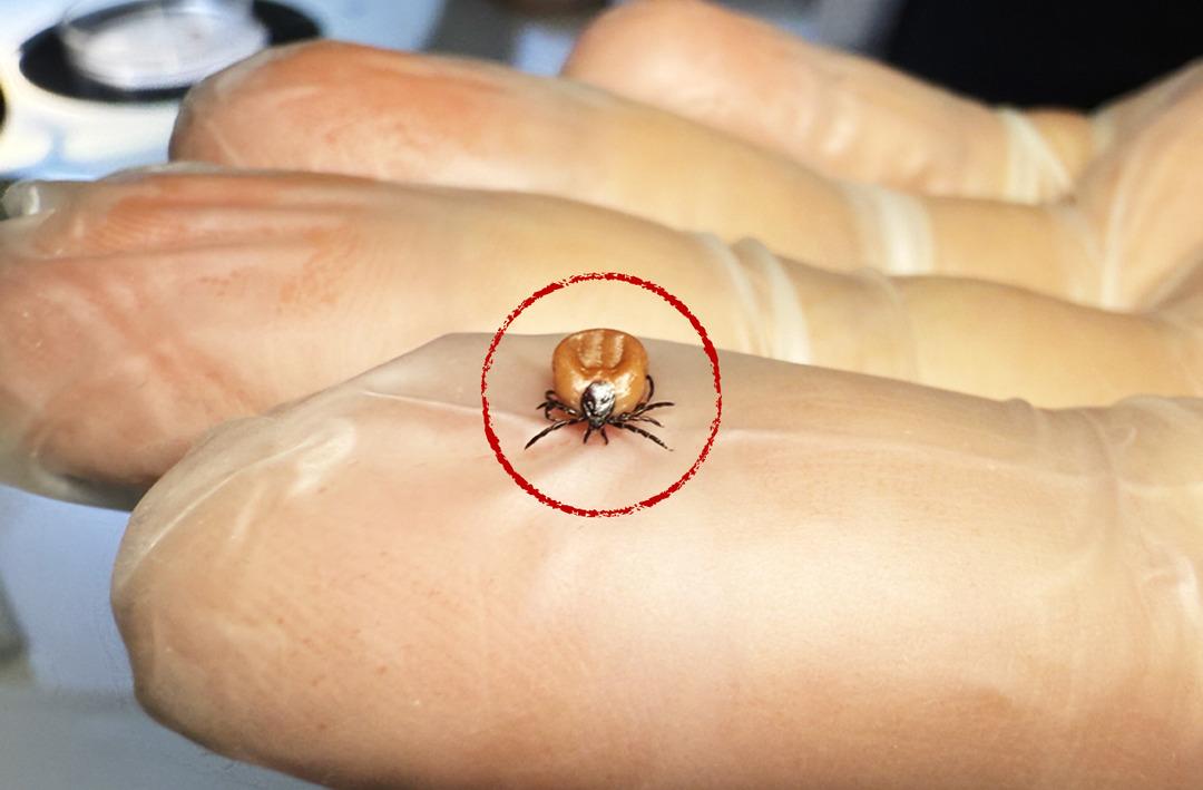 ABD'den sonra T&uuml;rkiye'de de g&ouml;r&uuml;ld&uuml;! V&uuml;cutta sessizce bekliyor, tedavi edilmezse beyne girip yerleşiyor!