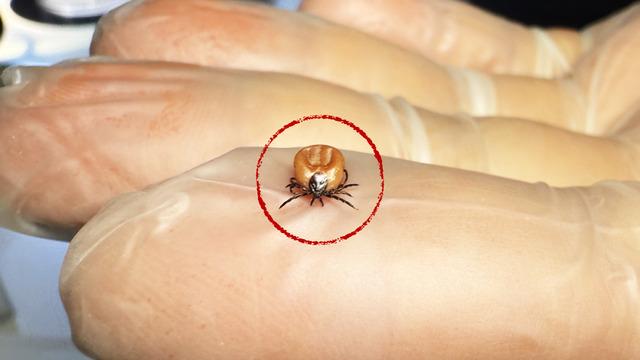 ABD'den sonra Türkiye'de de görüldü! Vücutta sessizce bekliyor, tedavi edilmezse beyne girip yerleşiyor!