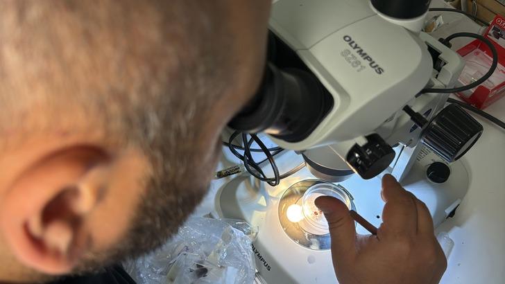 ABD'den sonra Türkiye'de de görüldü! Vücutta sessizce bekliyor, tedavi edilmezse beyne girip yerleşiyor! G4