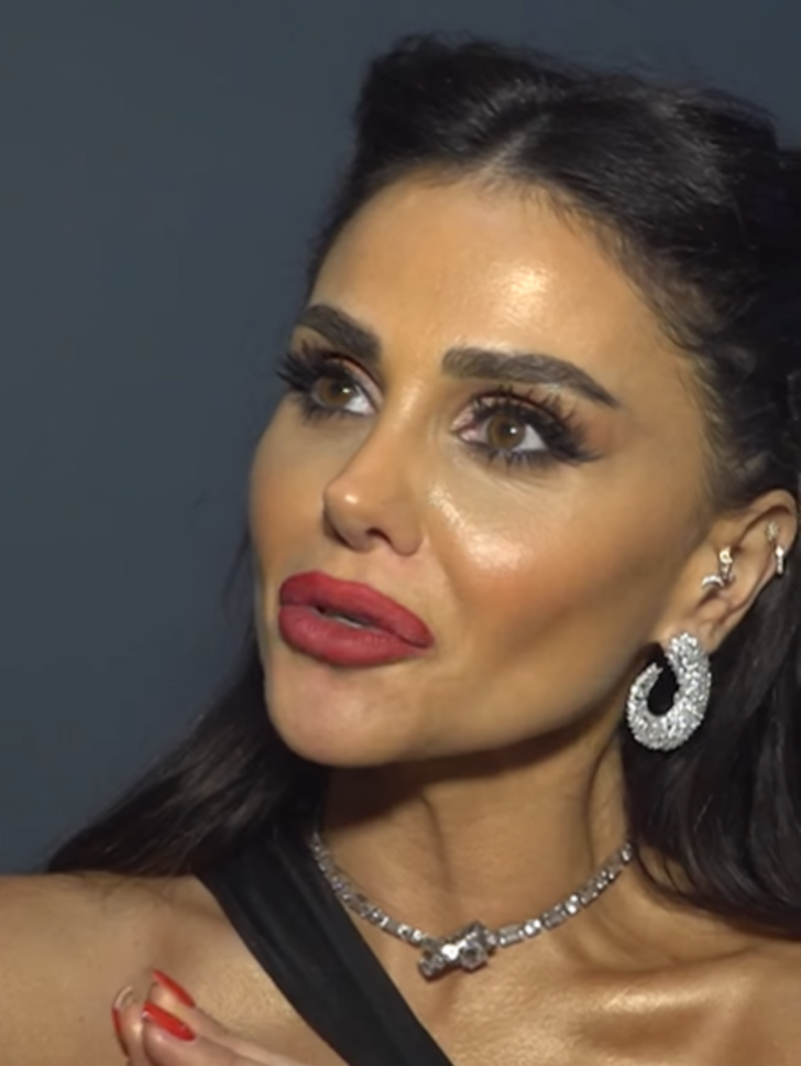 Azeri kızı Günel'in estetik açıklaması olay oldu! Kilosunu duyanlar inanamadı! 'Umurumda değil' diyerek tek tek saydı... G2