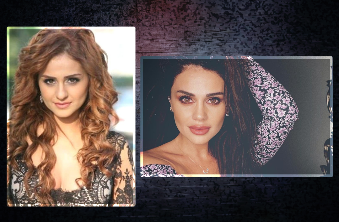 Azeri kızı G&uuml;nel'in estetik a&ccedil;ıklaması olay oldu! Kilosunu duyanlar inanamadı! 'Umurumda değil' diyerek tek tek saydı...