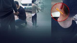 Kavgada tornavidayı boynuna sapladı! İstanbul'da sokak ortasında dehşete düşüren görüntü: Hastaneye de böyle gitti