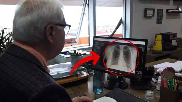 Prof. Dr. Özlü 'Vakalar arttı' diyerek uyardı! İşte en belirgin semptom...