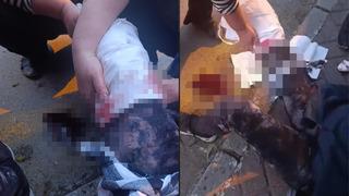 Ankara'da 9 köpeğin saldırısına uğrayan akademisyen Meliha Yılmaz yaralandı! Belgesel izler gibi gördük izledik bağırmaya başladık
