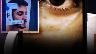 Çarpıcı görüntüler ilk kez ortaya çıktı! Soruşturmanın seyrini değiştirecek gelişme: Ağabey Enes Güran'ın yüzündeki morluk ve ısırık izleri...