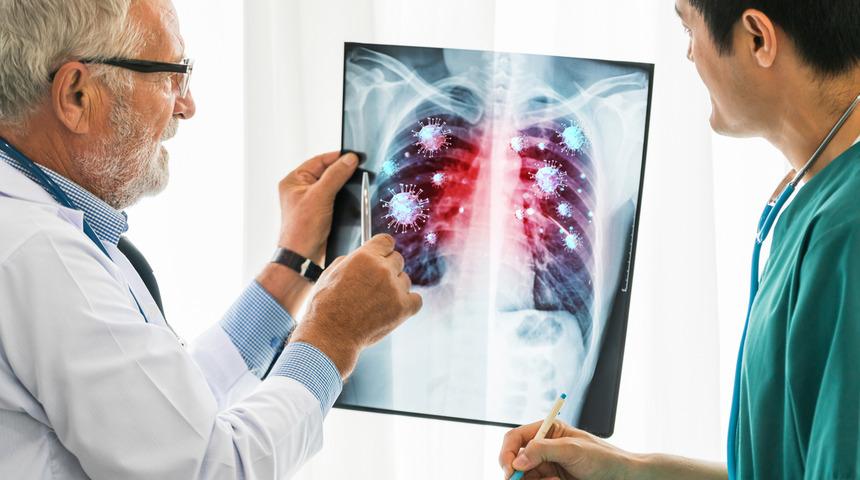 'Bulaşıcı olduğu kadar ölümcül' Uzman isim 'Yoğun bakımlık yapabilir' diyerek uyardı! İşte alınması gereken önlemler...