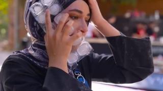 Yüzüne kızgın yağ dökülmüştü! MasterChef Beyza son durumunu anlattı! 'İz kalmaması için...'