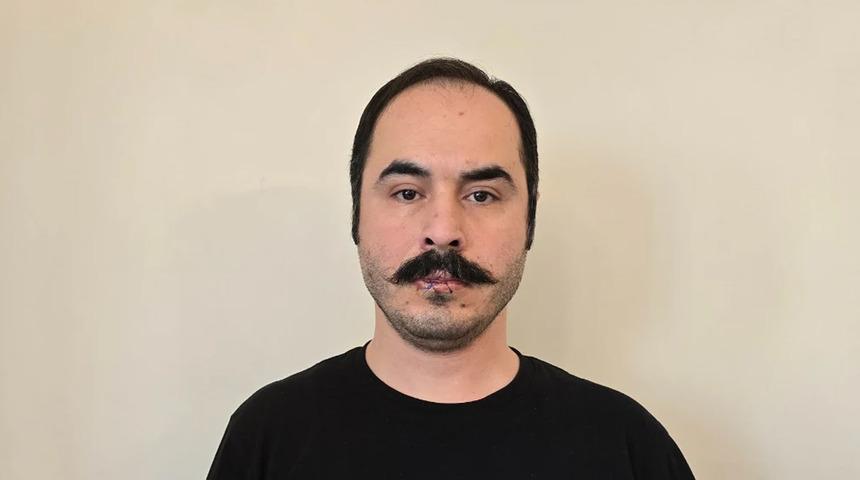 İğne iplik aldı, dudaklarını dikti! Hüseyin Roneki tüm dünyaya duyurdu: "Mühürlü kalacak"