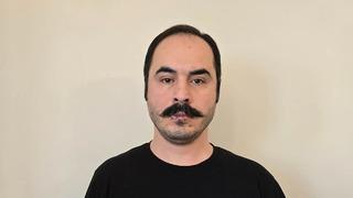 İğne iplik aldı, dudaklarını dikti! Hüseyin Roneki tüm dünyaya duyurdu: Mühürlü kalacak