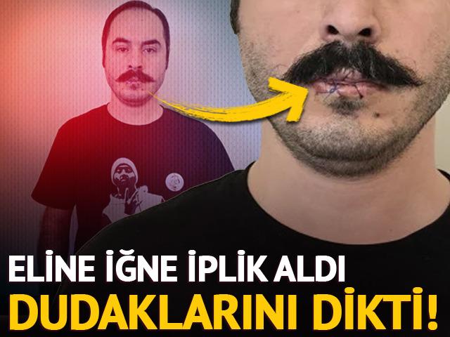 İğne iplik aldı, dudaklarını dikti! 