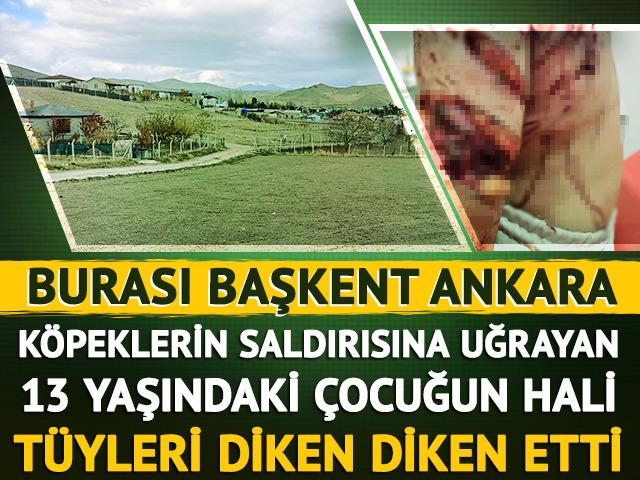 Köpek saldırısına uğrayan 13 yaşındaki çocuğun hali tüyleri diken diken etti