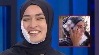 Kızgın yağ ile yüzü yanan Beyza bandajı çıkardı! Görenler inanamadı: Bu duruma kurgu diyenler var