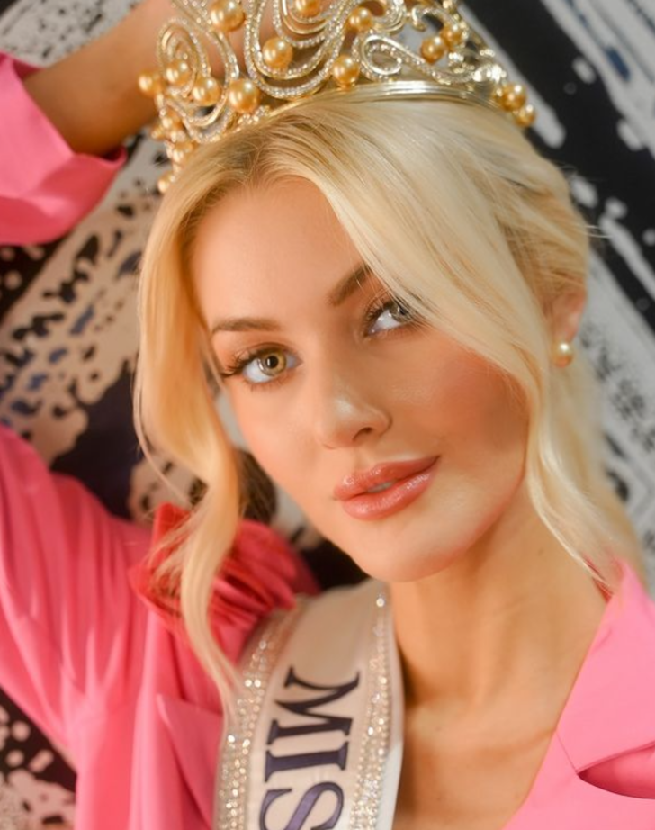 2024 Kainat Güzeli seçilmişti! Victoria Kjær Theilvig'in makyajsız hali olay oldu! Estetikleri dikkat çekti... G4