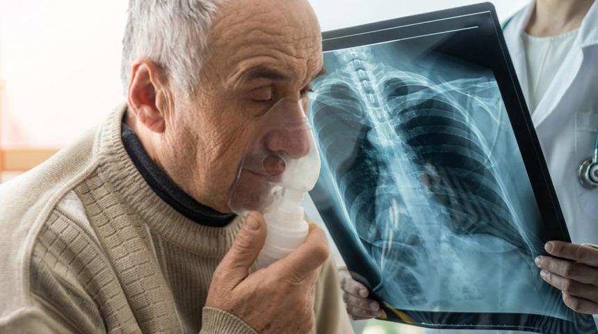 Dünyada 4. ülkemizde 3. ölüm nedeni! 3 haftadan fazla süren öksürük tehlikenin habercisiymiş