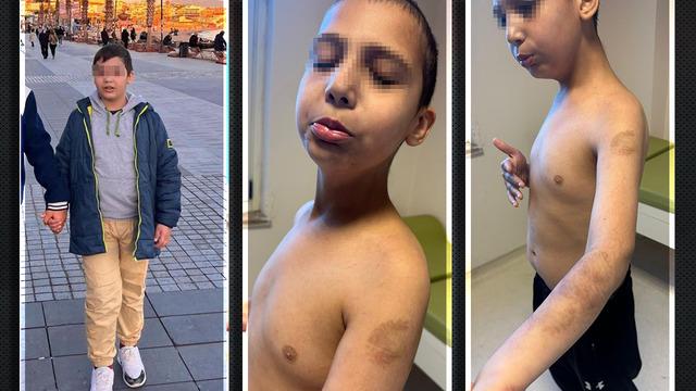 'Hayatımda görebileceğim en kötü şeydi' İstanbul'da otizmli çocuğa işkence! Hemşireden skandal sözler: Beğenmiyorsanız kendiniz baksaydınız