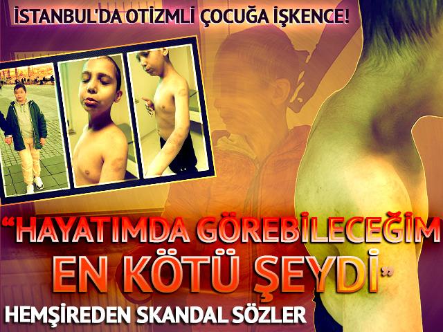 'Hayatımda görebileceğim en kötü şeydi' İstanbul'da otizmli çocuğa işkence! Hemşireden skandal sözler: Beğenmiyorsanız kendiniz baksaydınız